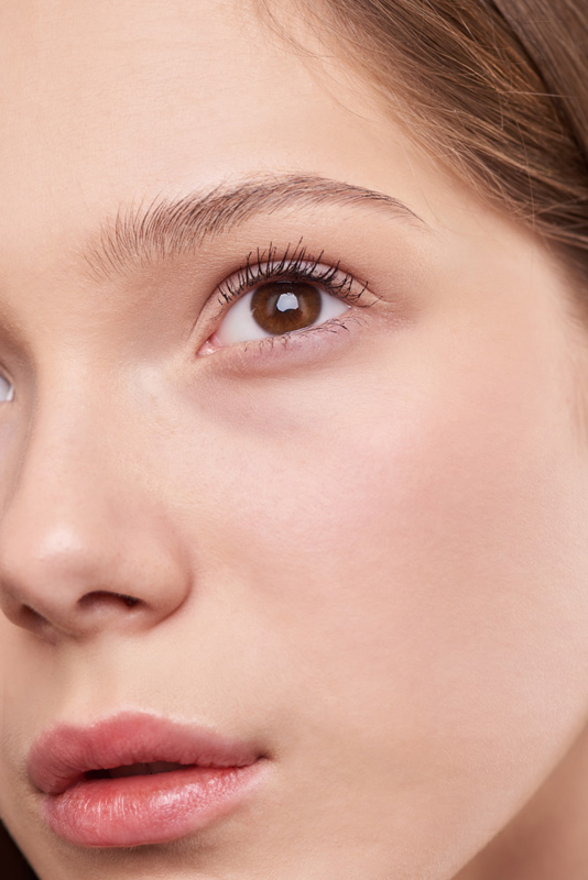 Blefaroplastia sin cirugía