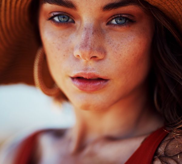 mesoterapia facial con vitaminas