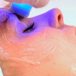 Luce una piel radiante y joven con radiofrecuencia facial