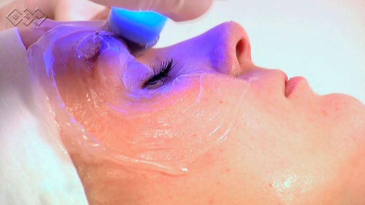 Luce una piel radiante y joven con radiofrecuencia facial